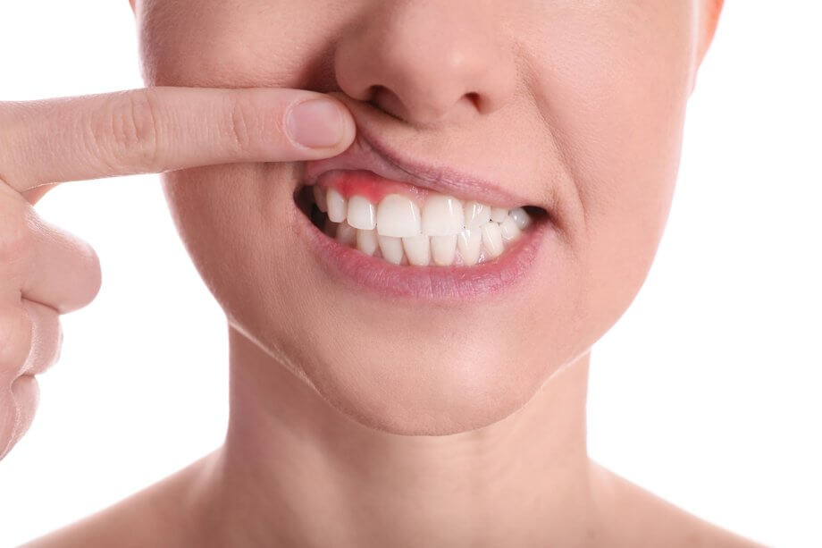 5 Warning Signs of Gum Disease That Forty Fort Residents Shouldn't Ignore