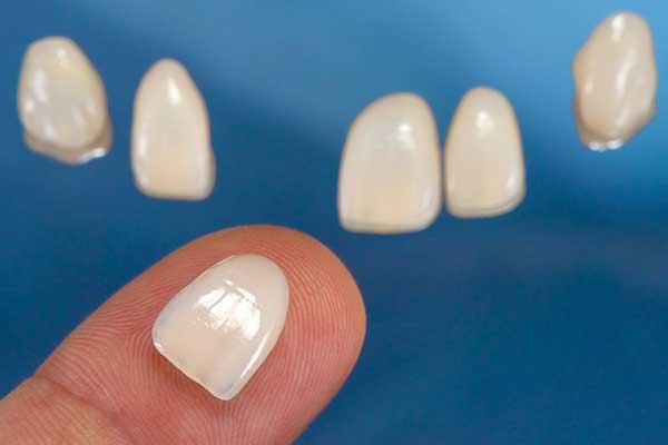 Porcelain Veneers in Forty Fort, PA