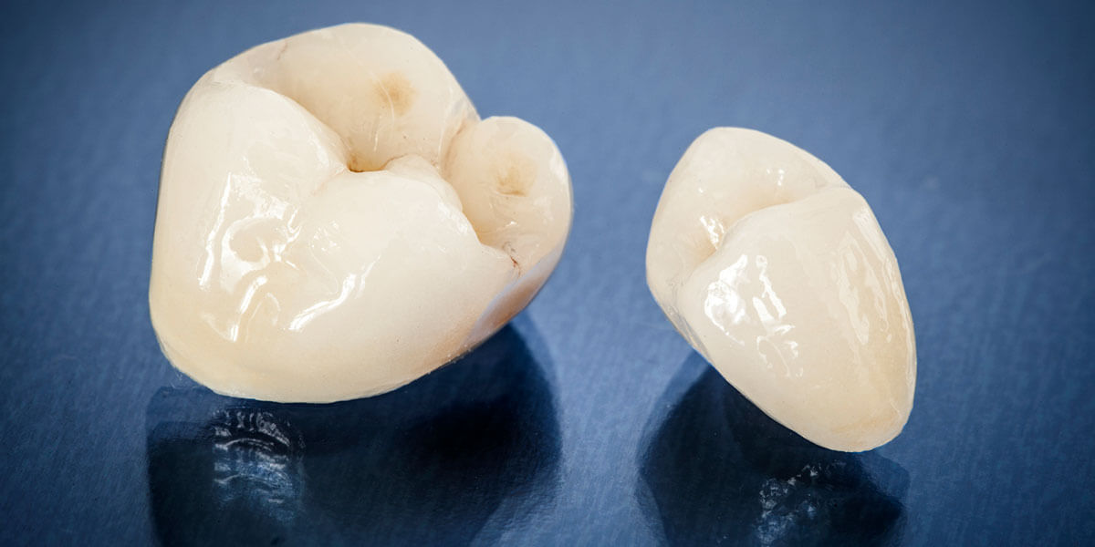 Porcelain Dental Crowns