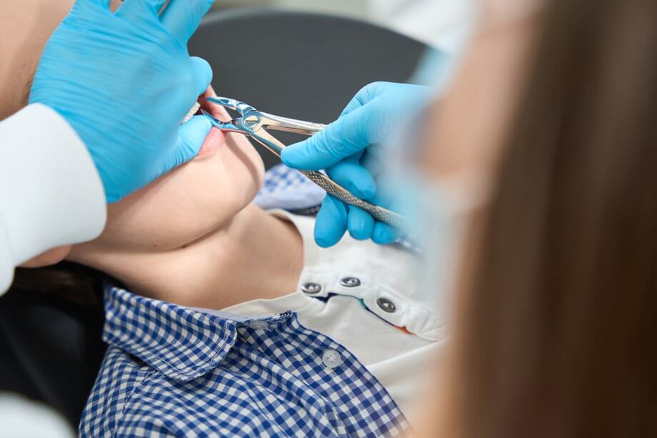 How Smoking Affects Healing After a Tooth Extraction (And How to Improve Recovery)