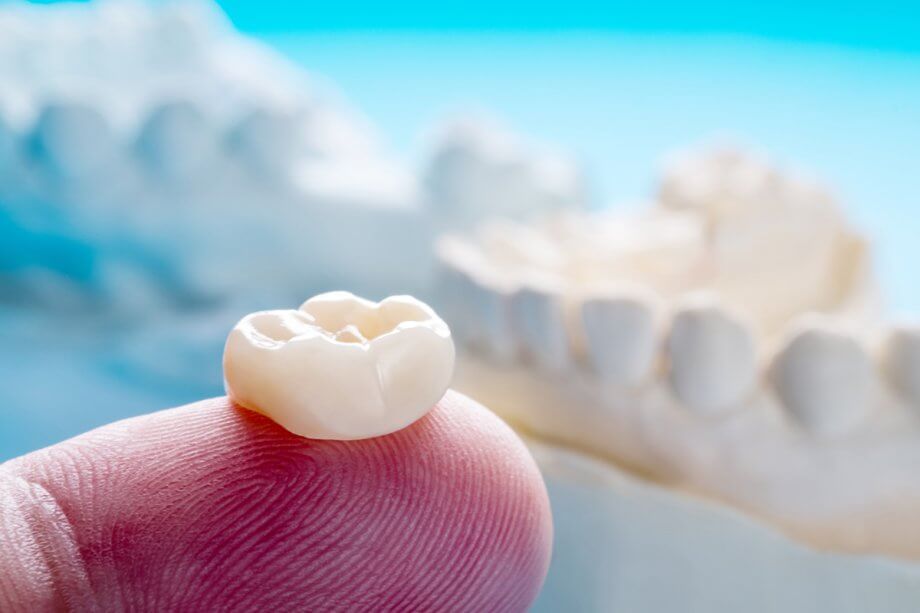 What are Dental Crowns Made Of?